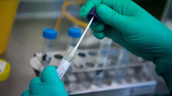 В Камчатском крае выявлены ещё 38 лабораторно подтверждённых случаев заболевания коронавирусом